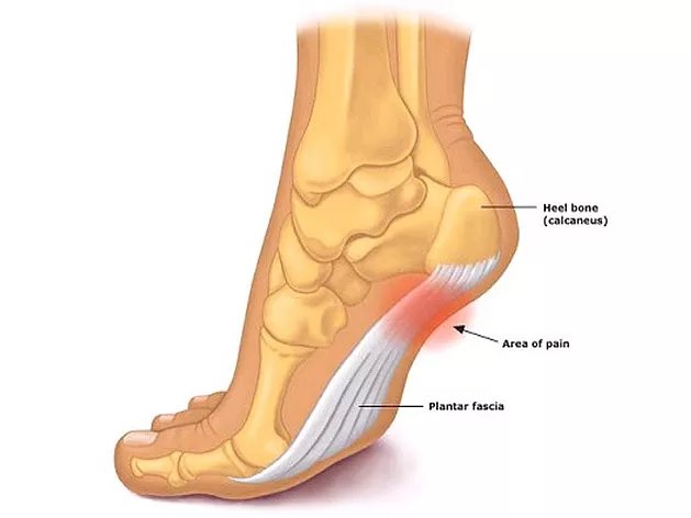 Foot Pain Treatment Orlando